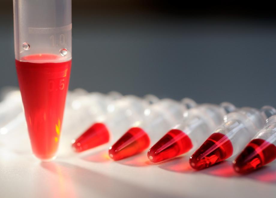 Predictive toxicology
